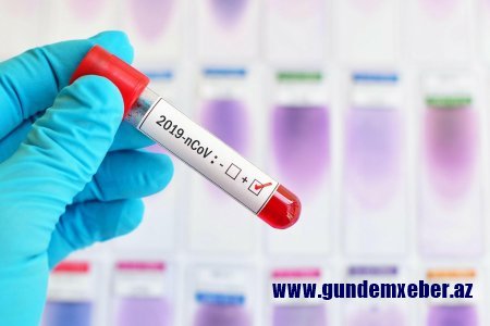Azərbaycanda daha 369 nəfər koronavirusa yoluxub, 523 nəfər sağalıb