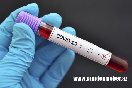 Azərbaycanın işğal altındakı ərazilərində COVID-19-a yoluxanların sayı 385 nəfərə çatıb
